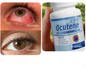 Ocuten
